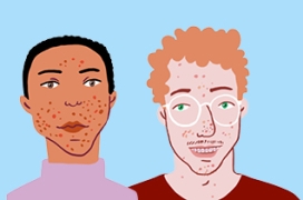 Puberté visages jeunes