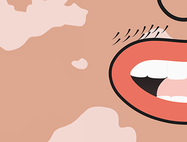 Bouche ado dessinée_Moustache et vitiligo