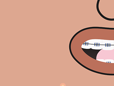 Bouche ado dessiné_Appareils dentaires et acné
