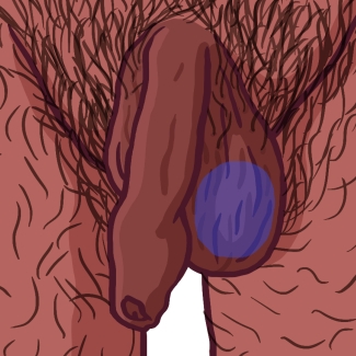 illustration d'un testicule et scrotum avec légendes